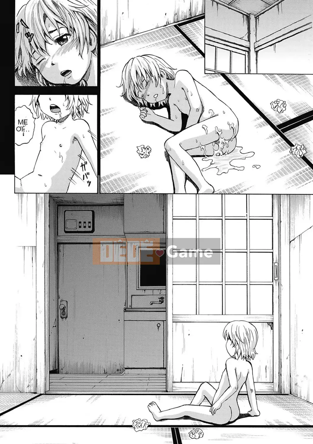 [Kawady MAX] Những cô gái đầy sẹo