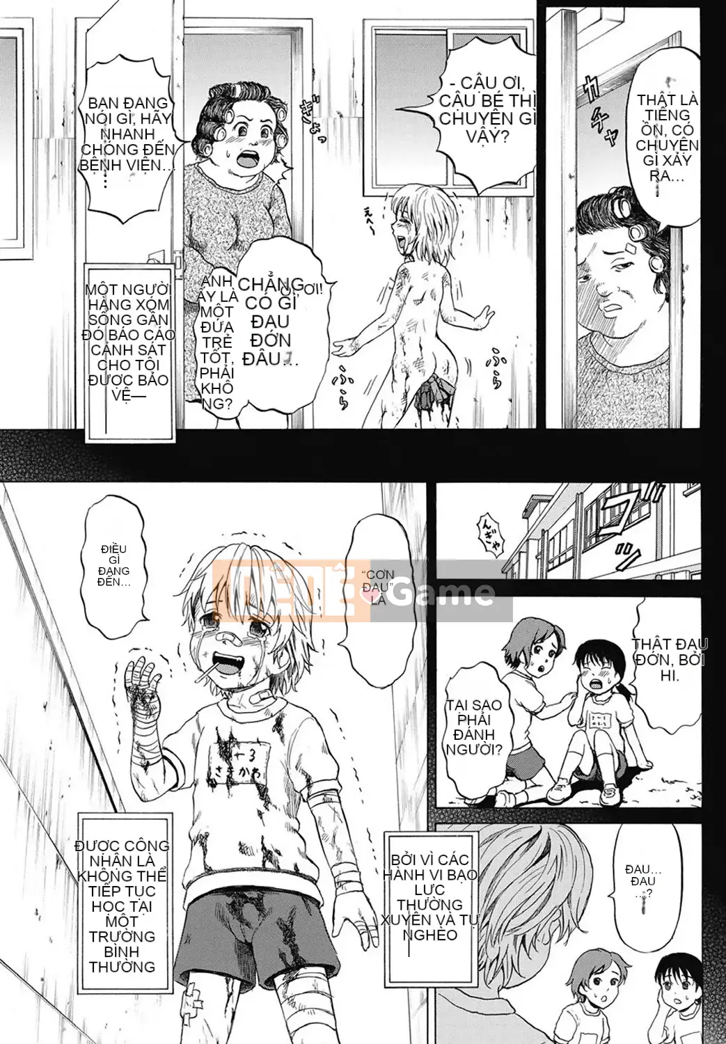 [Kawady MAX] Những cô gái đầy sẹo