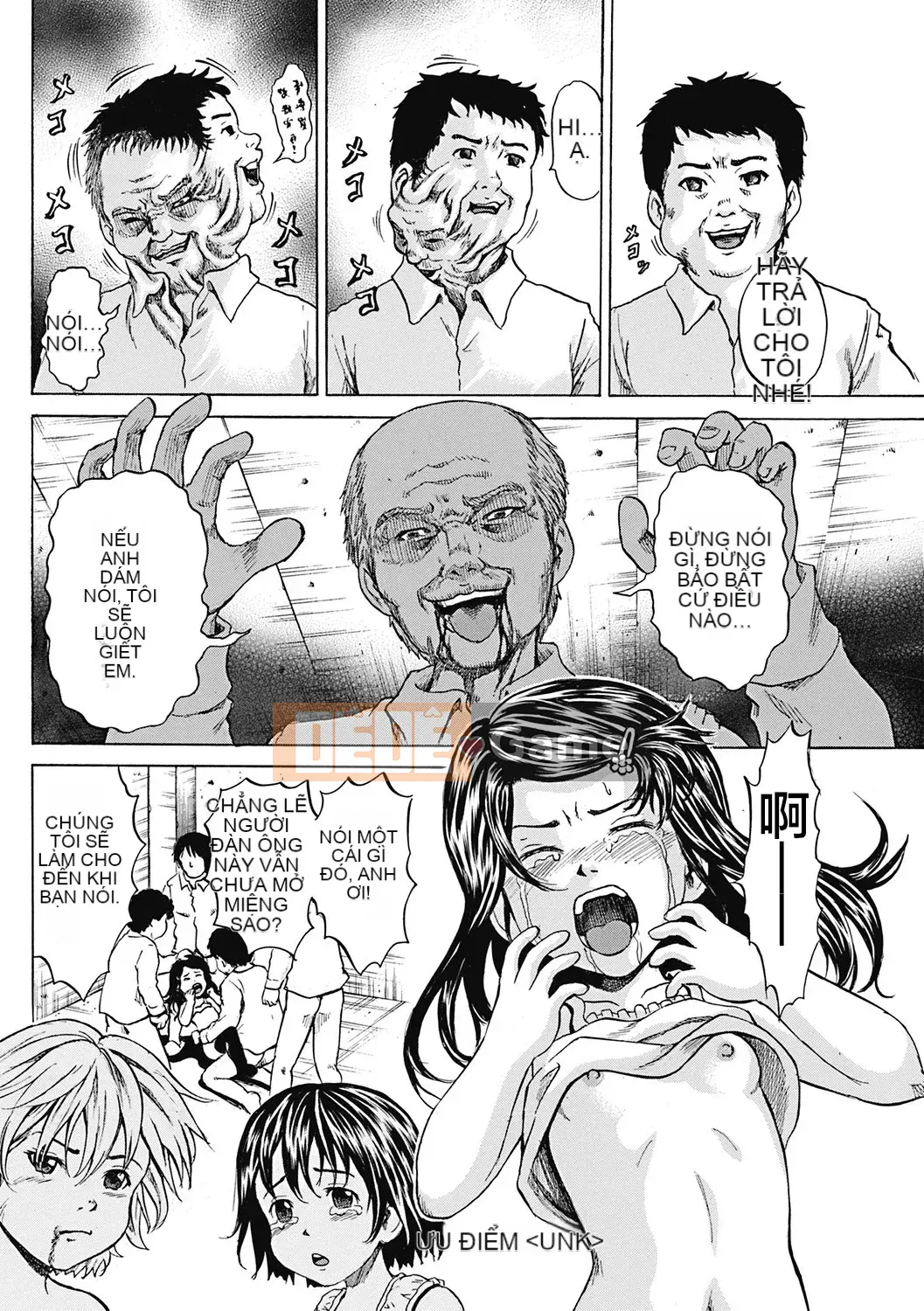 [Kawady MAX] Những cô gái đầy sẹo