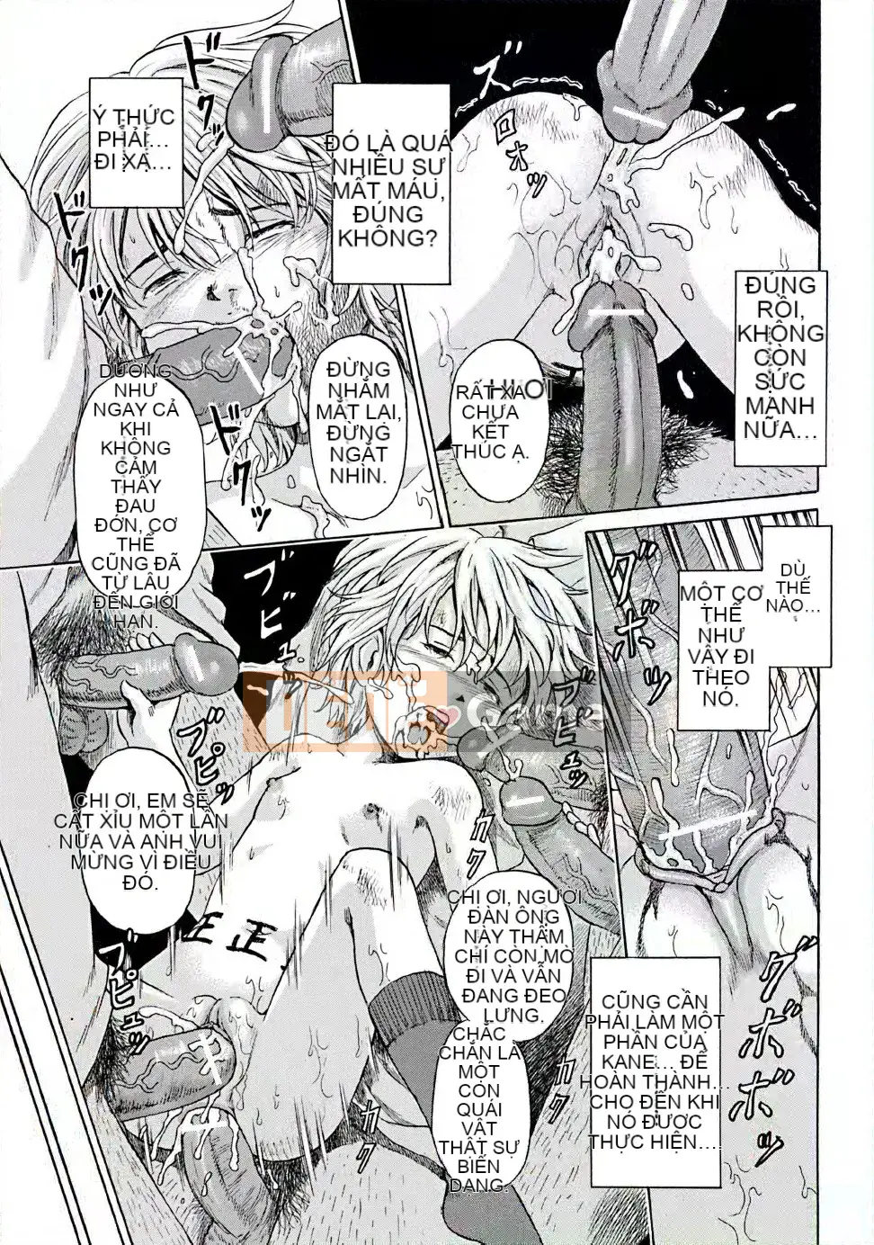 [Kawady MAX] Những cô gái đầy sẹo