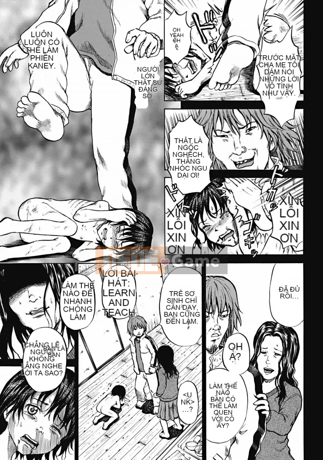 [Kawady MAX] Những cô gái đầy sẹo