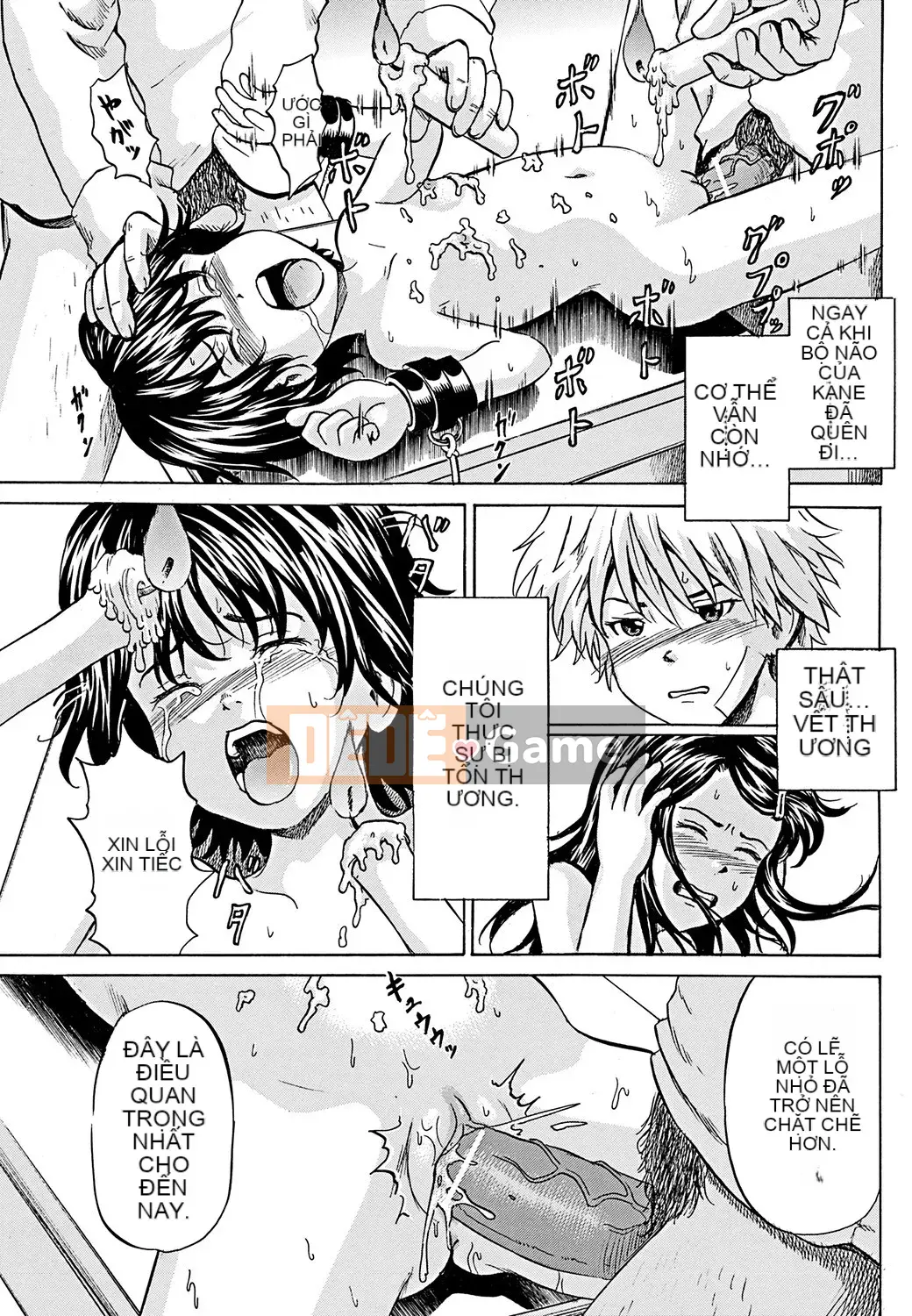 [Kawady MAX] Những cô gái đầy sẹo