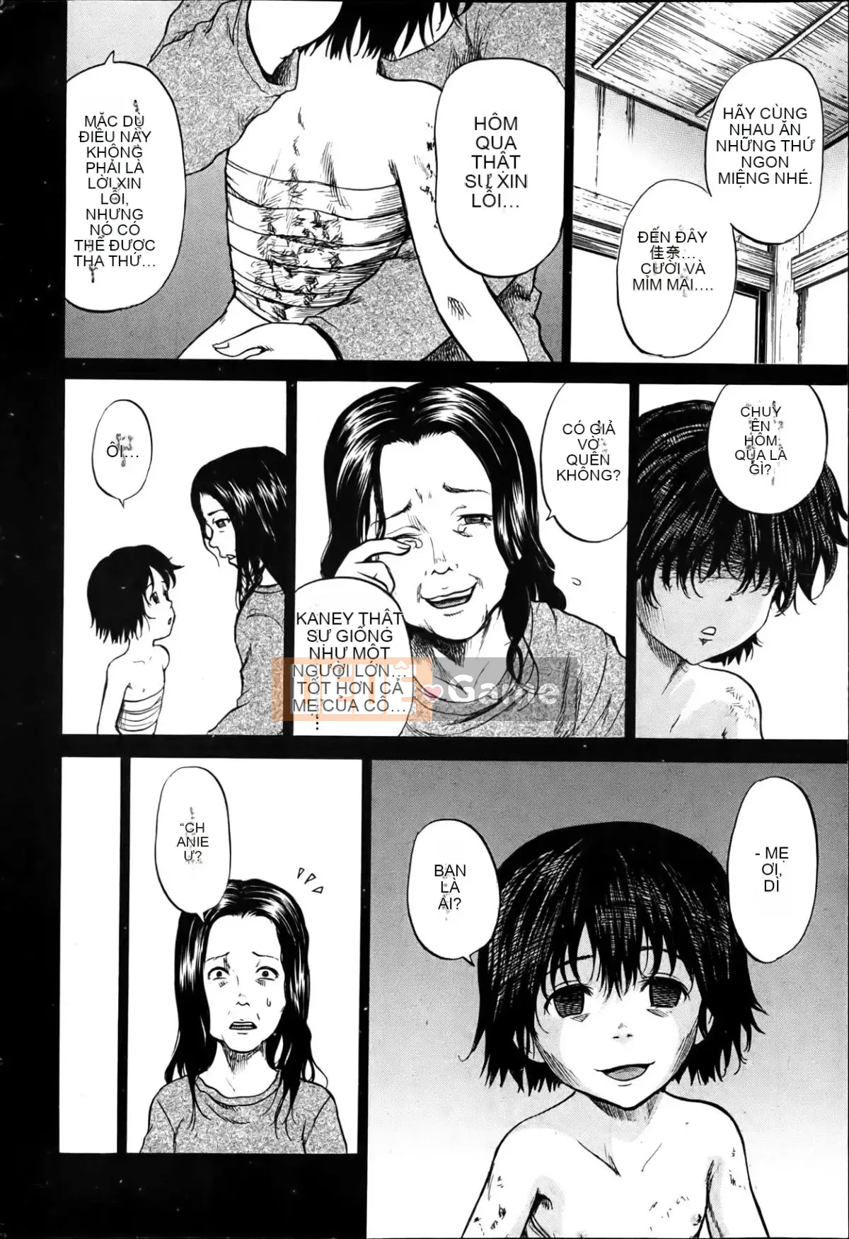 [Kawady MAX] Những cô gái đầy sẹo