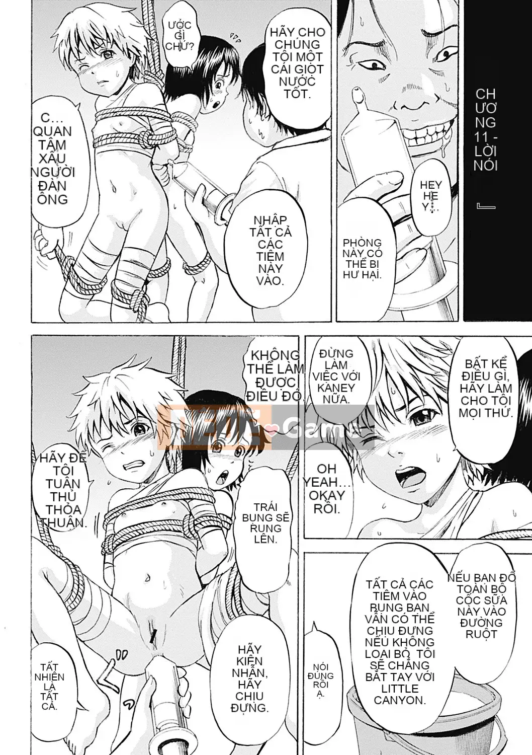 [Kawady MAX] Những cô gái đầy sẹo