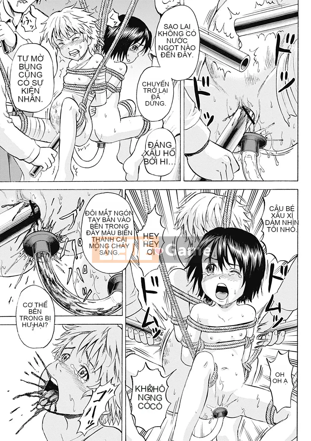 [Kawady MAX] Những cô gái đầy sẹo