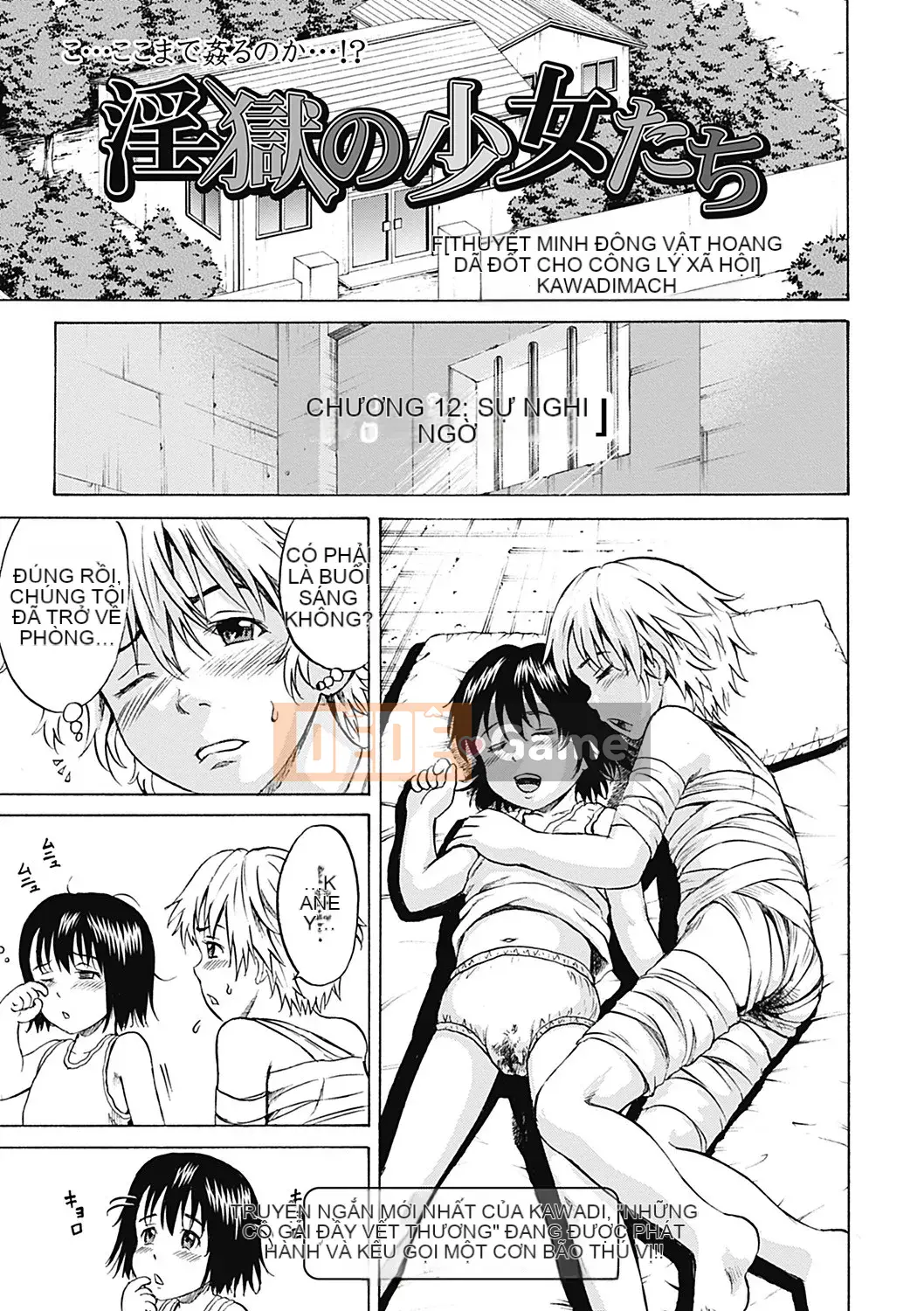 [Kawady MAX] Những cô gái đầy sẹo