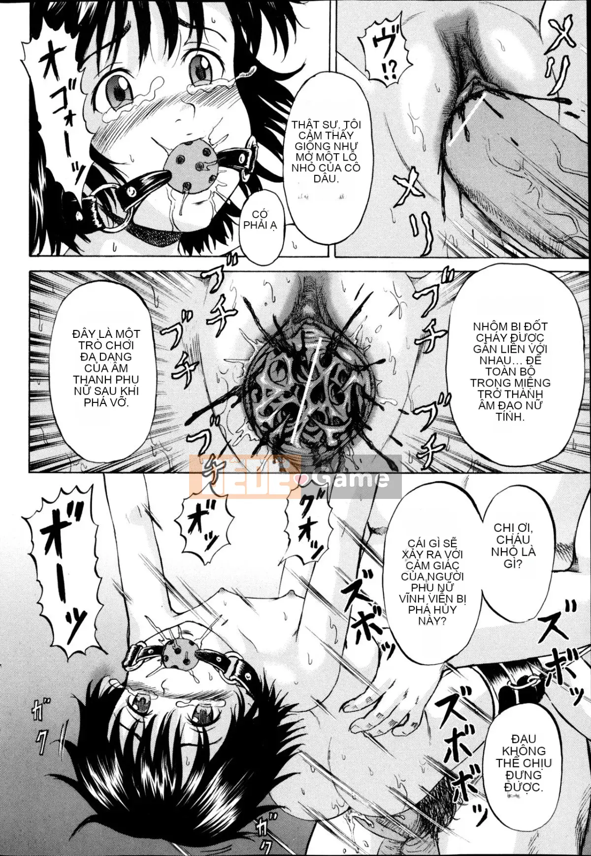 [Kawady MAX] Những cô gái đầy sẹo