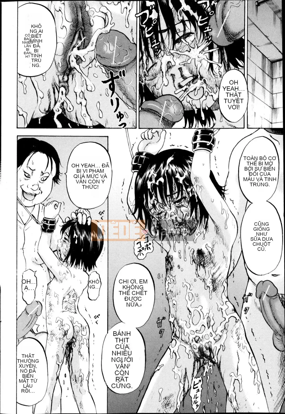 [Kawady MAX] Những cô gái đầy sẹo