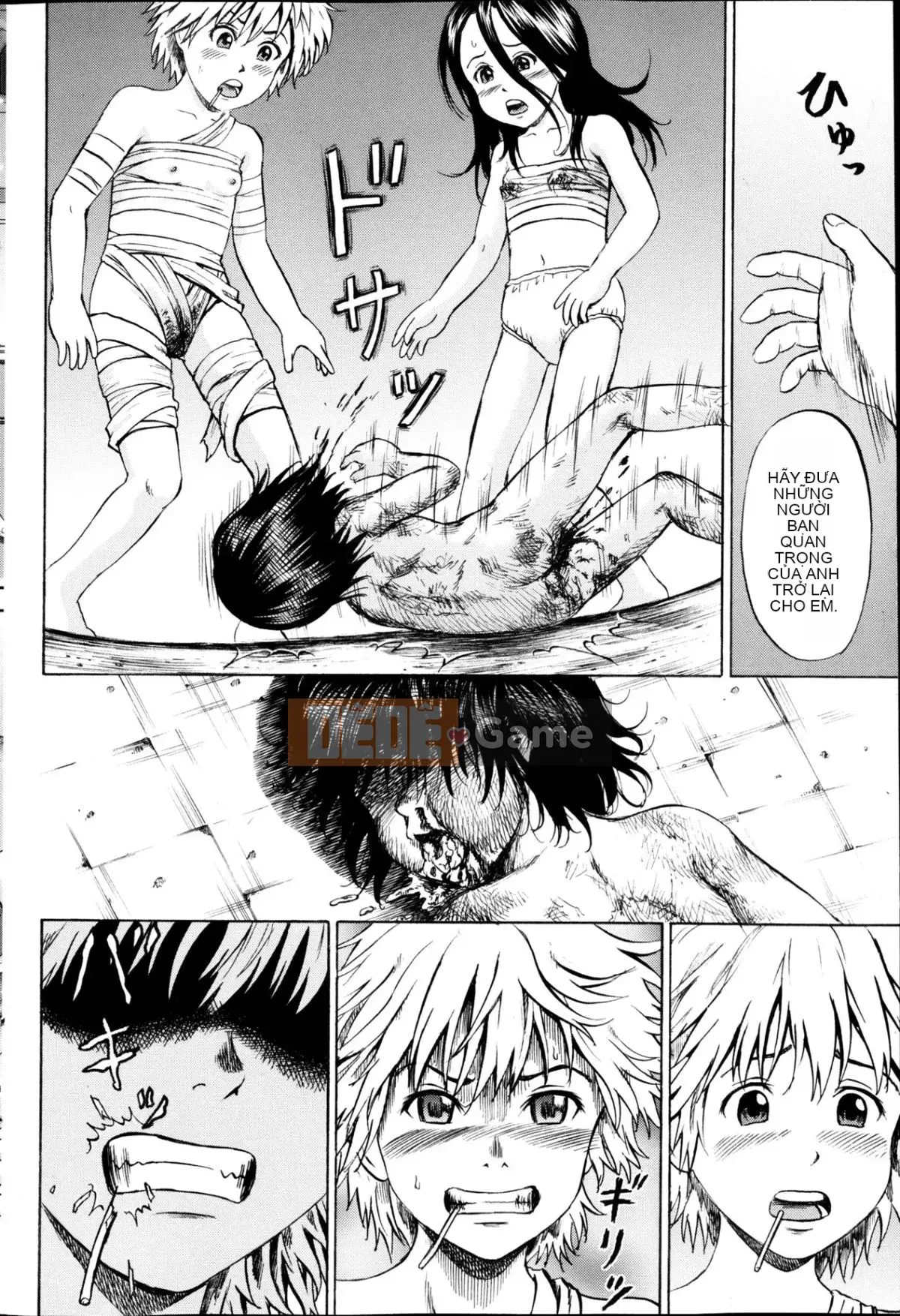 [Kawady MAX] Những cô gái đầy sẹo