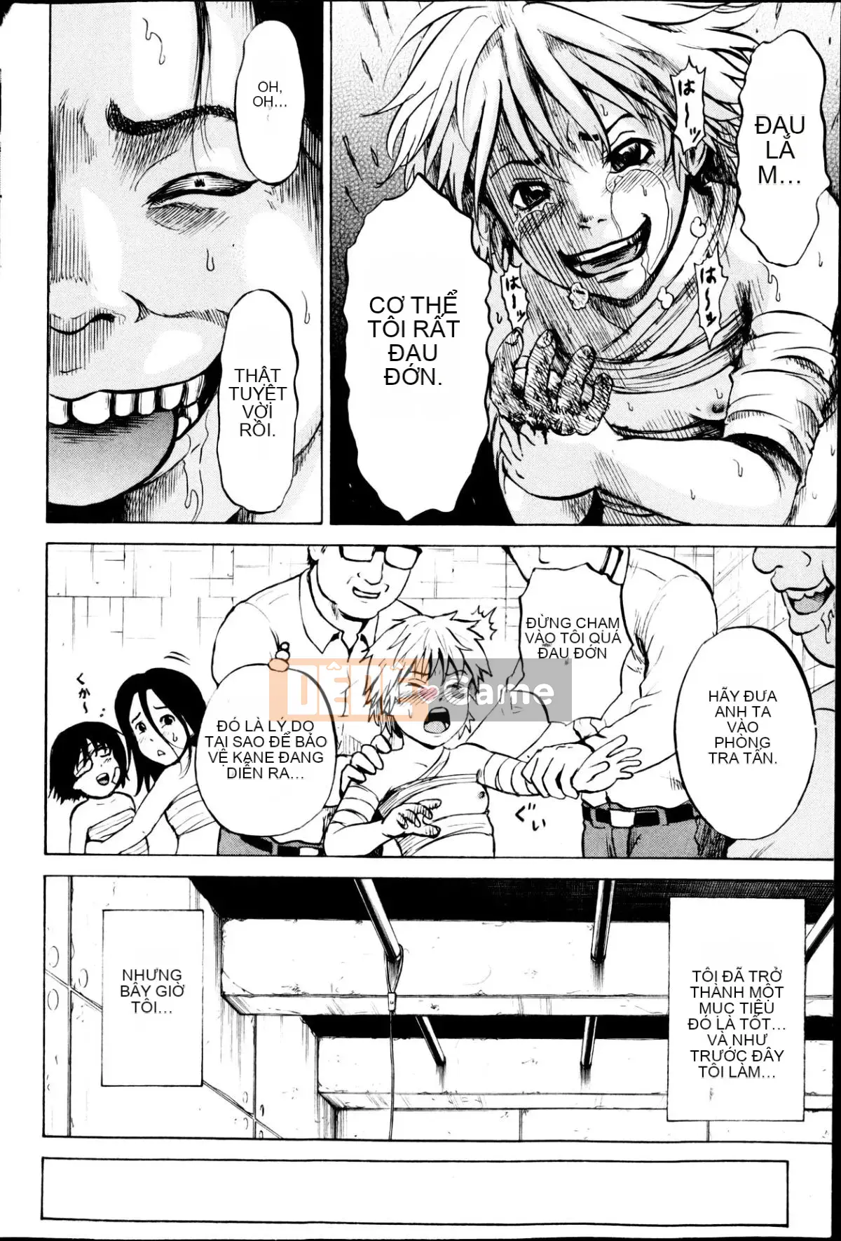 [Kawady MAX] Những cô gái đầy sẹo