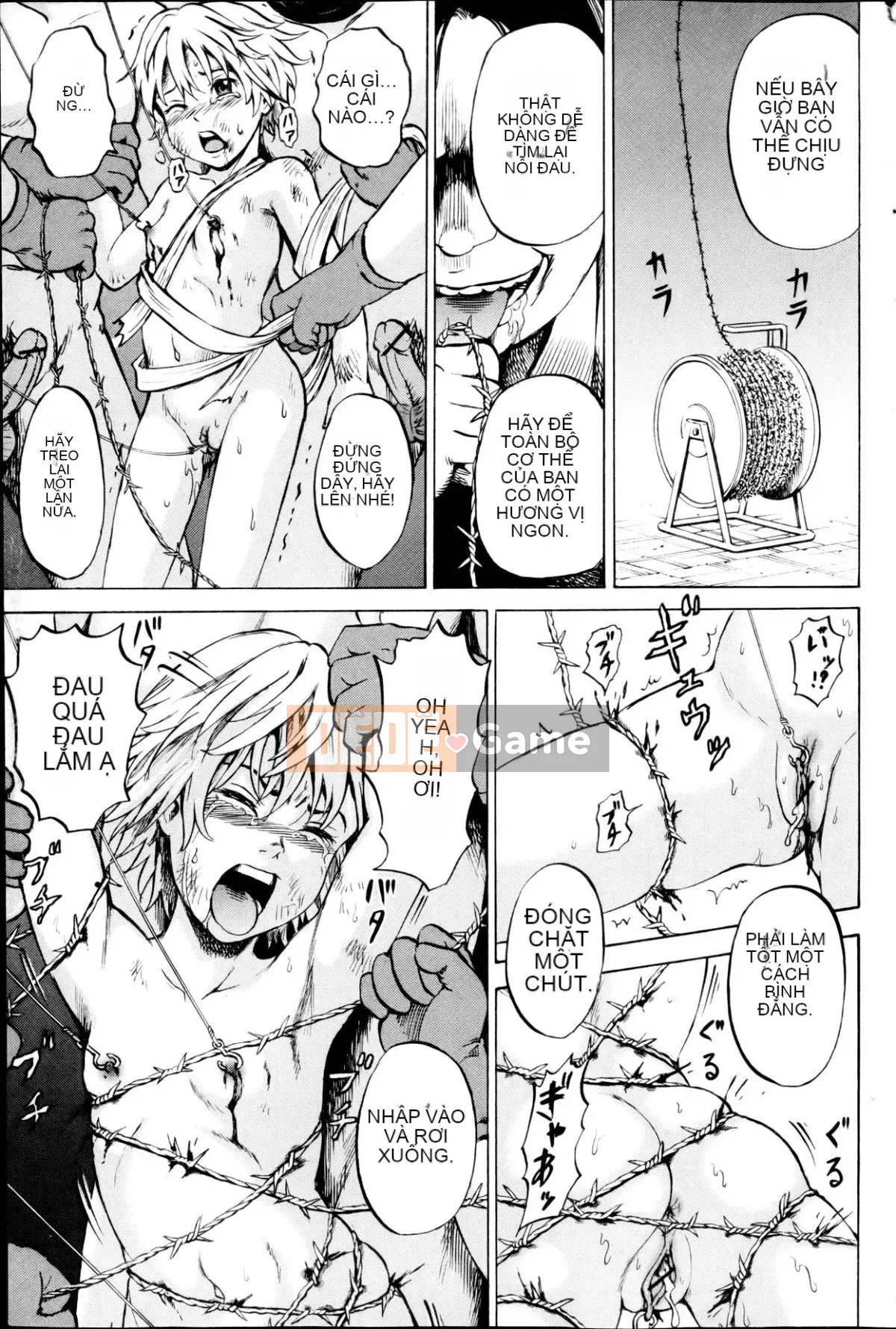 [Kawady MAX] Những cô gái đầy sẹo