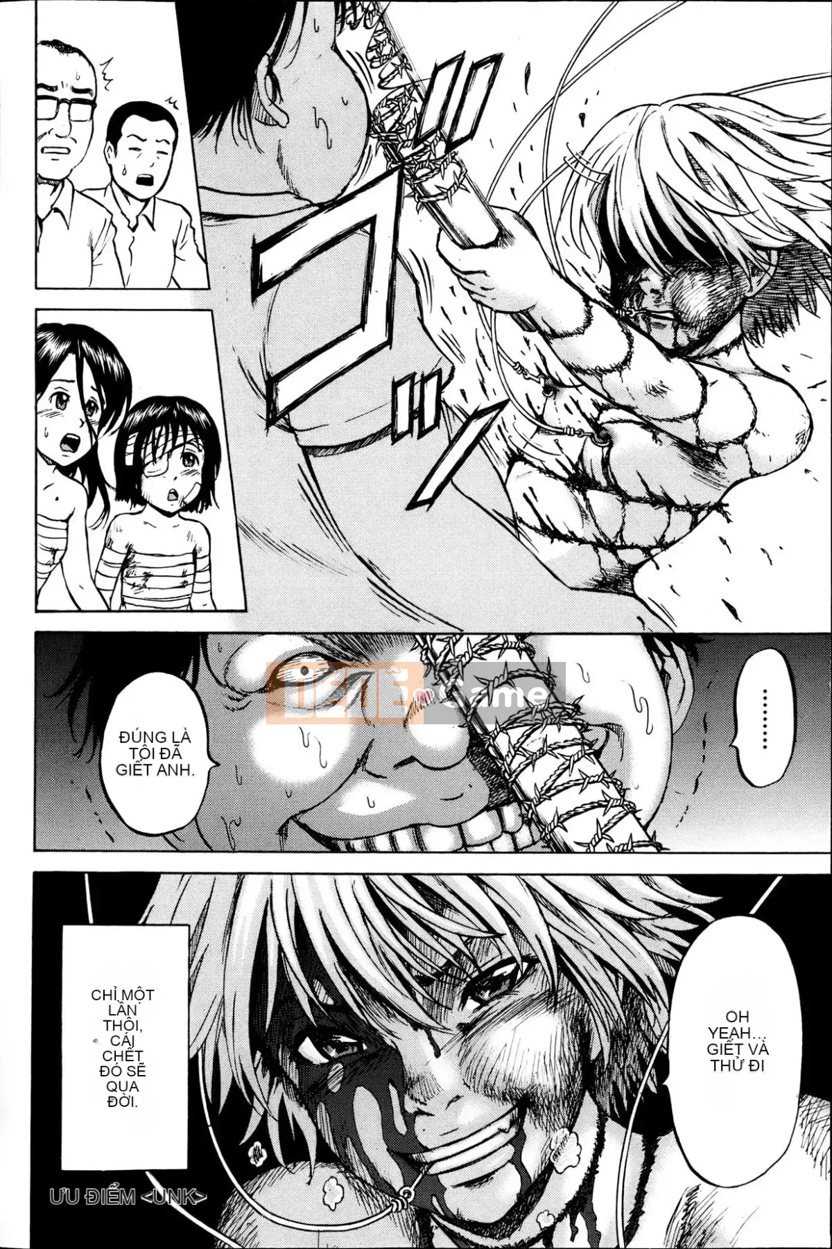 [Kawady MAX] Những cô gái đầy sẹo