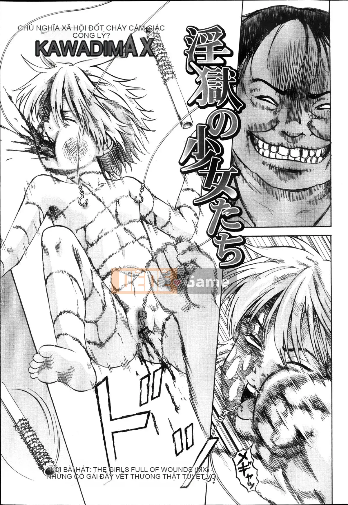 [Kawady MAX] Những cô gái đầy sẹo