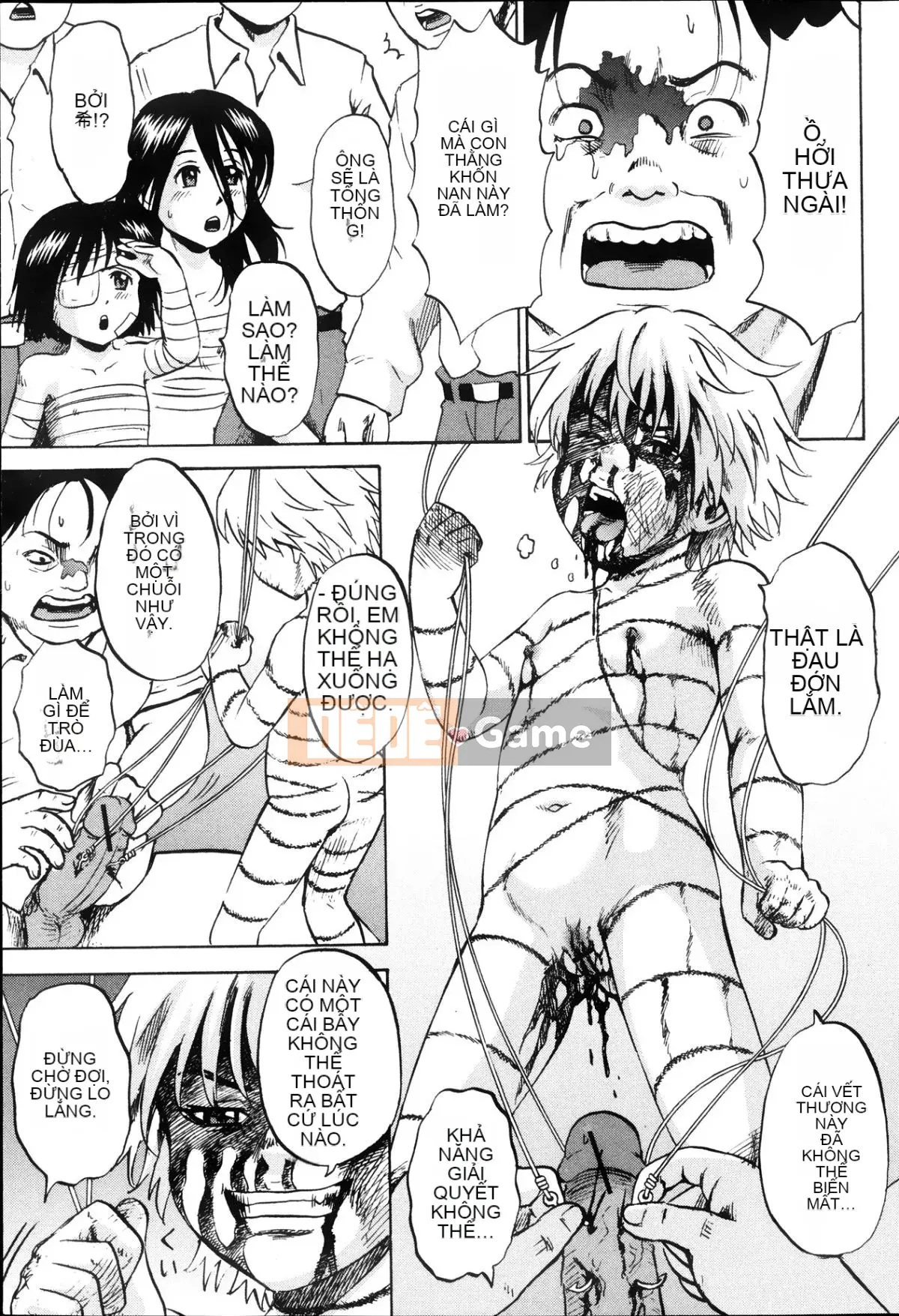 [Kawady MAX] Những cô gái đầy sẹo