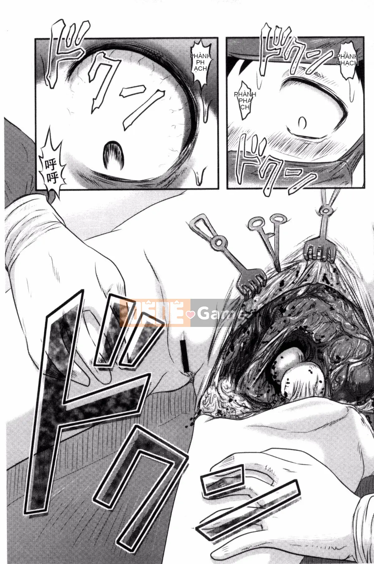 [Wind Workshop][Shiga Yta] Organ tuyệt vọng