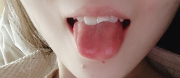 [Thzu.cc] LOL cô gái Ericahand hình ảnh