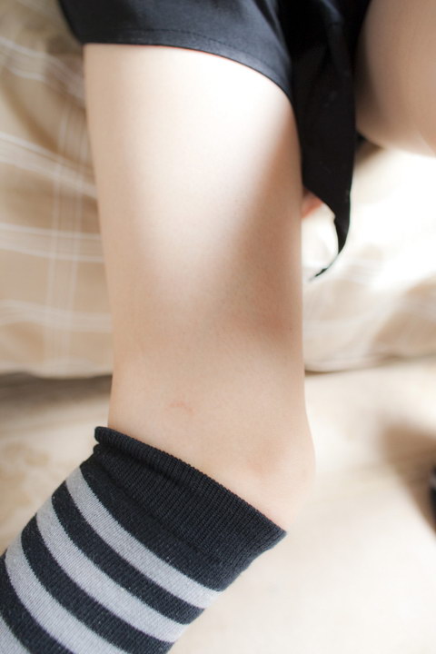 Vùng tuyệt đối Vol.2 ~ Sọc đầu gối sọc phiên bản ~