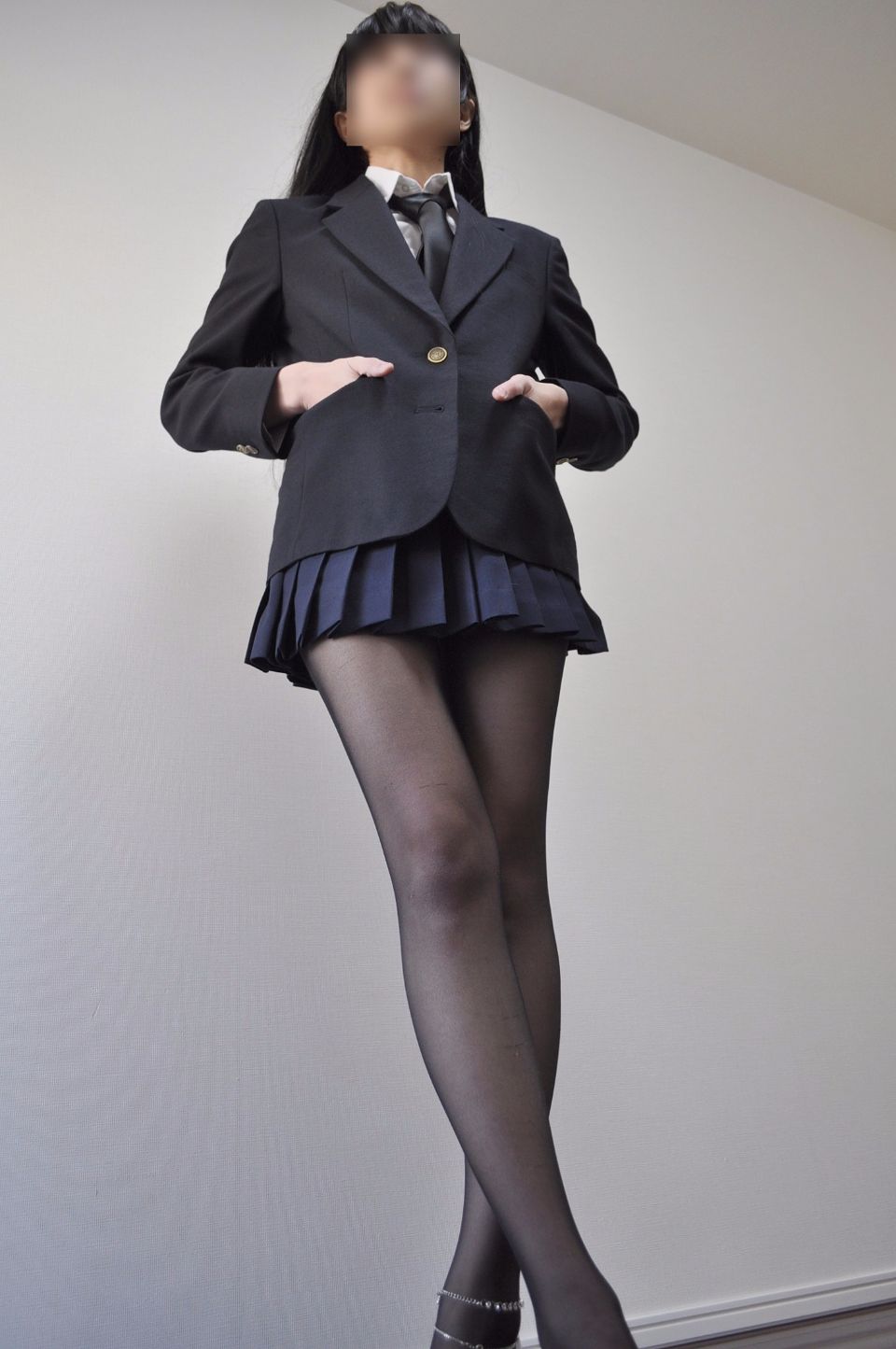 Mức độ cực đoan ☆ chân đen chân đẹp