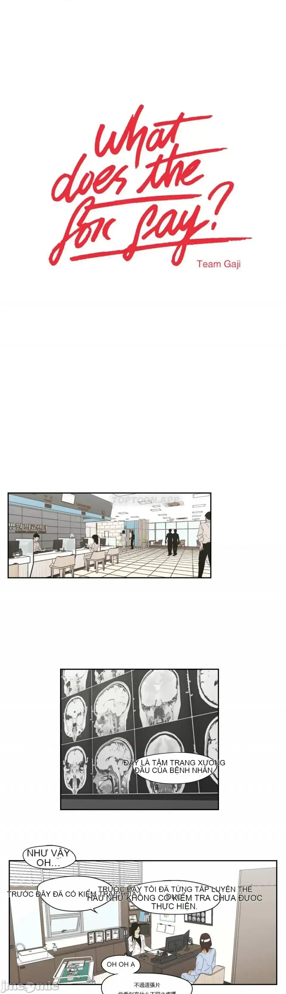 Cái gì -Làm -con cáo -Nói Chương 1-134